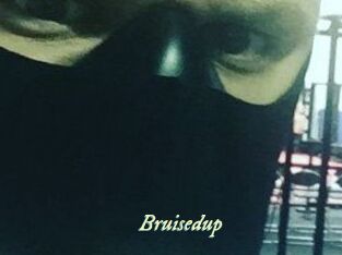 Bruisedup