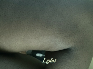 Lgdat