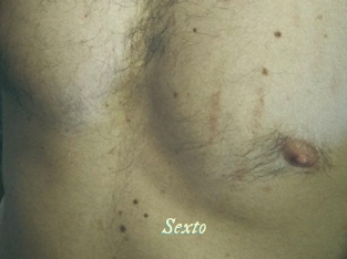 sexto Année du sexe